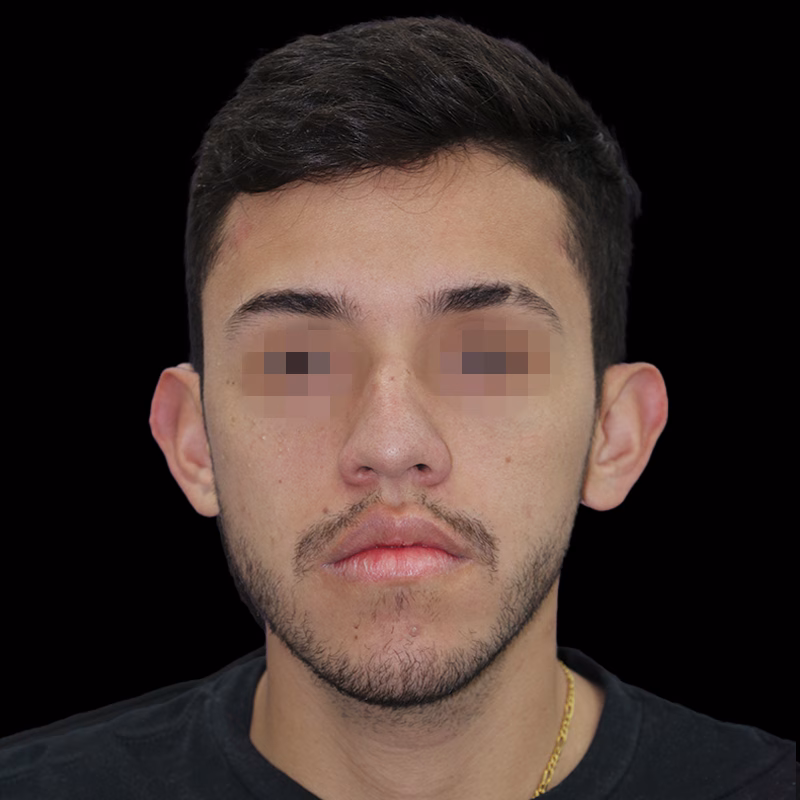 m antes 4